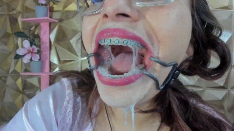 mouth tongue braces teeth by auro smith chaturbate.com